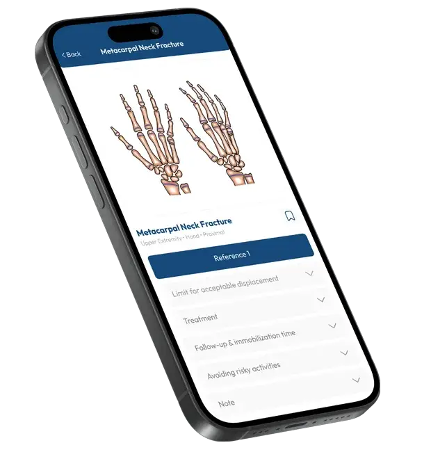 factopedia app show fracture view into iphone mockup